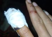 Siswa SMP 10 Parsingguran Alami Kecelakaan Kerja, Pihak Sekolah Diduga Lalai