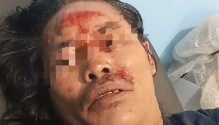 Seorang Wartawan di Taput Diduga Dianiaya Brutal oleh Oknum Kades